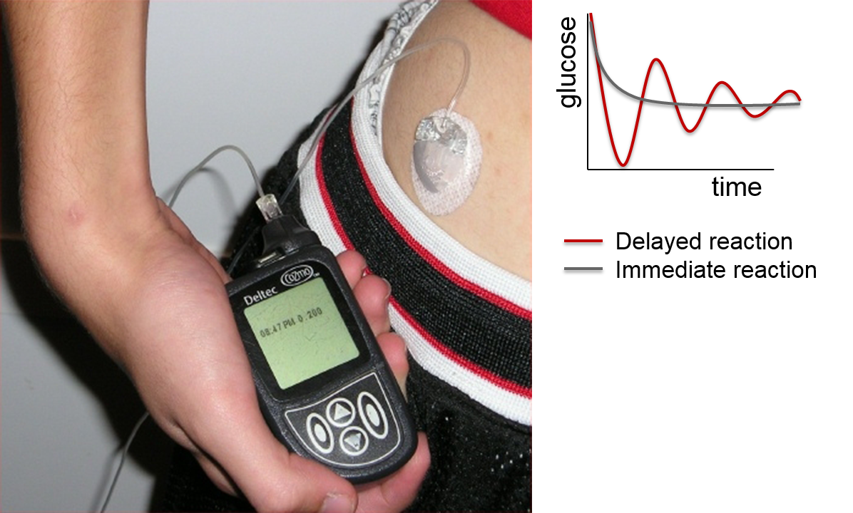 Insulin oscillations in a diabetes patient, who injects insulin late.